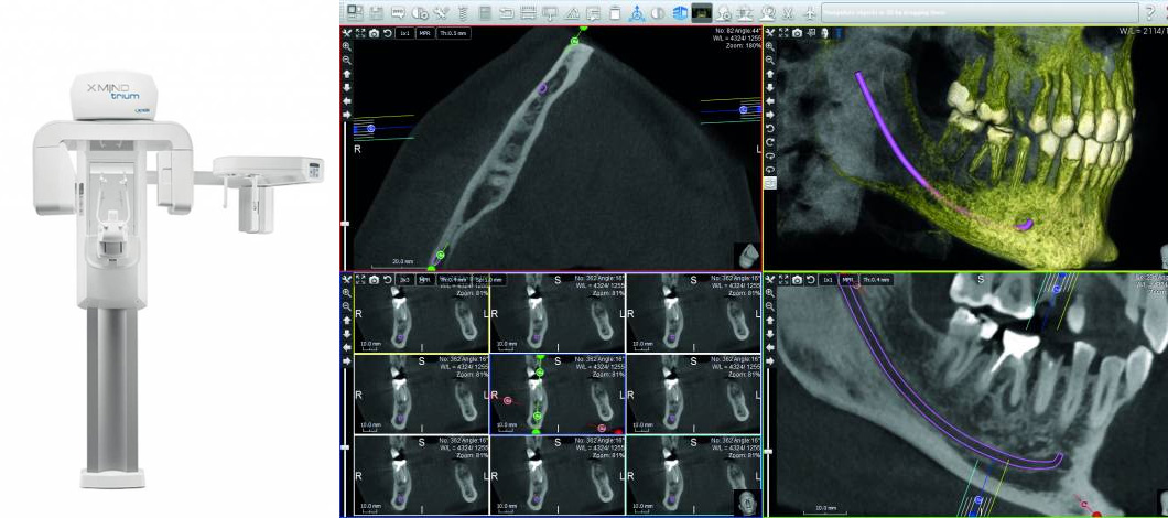 The latest in 3D dental imaging